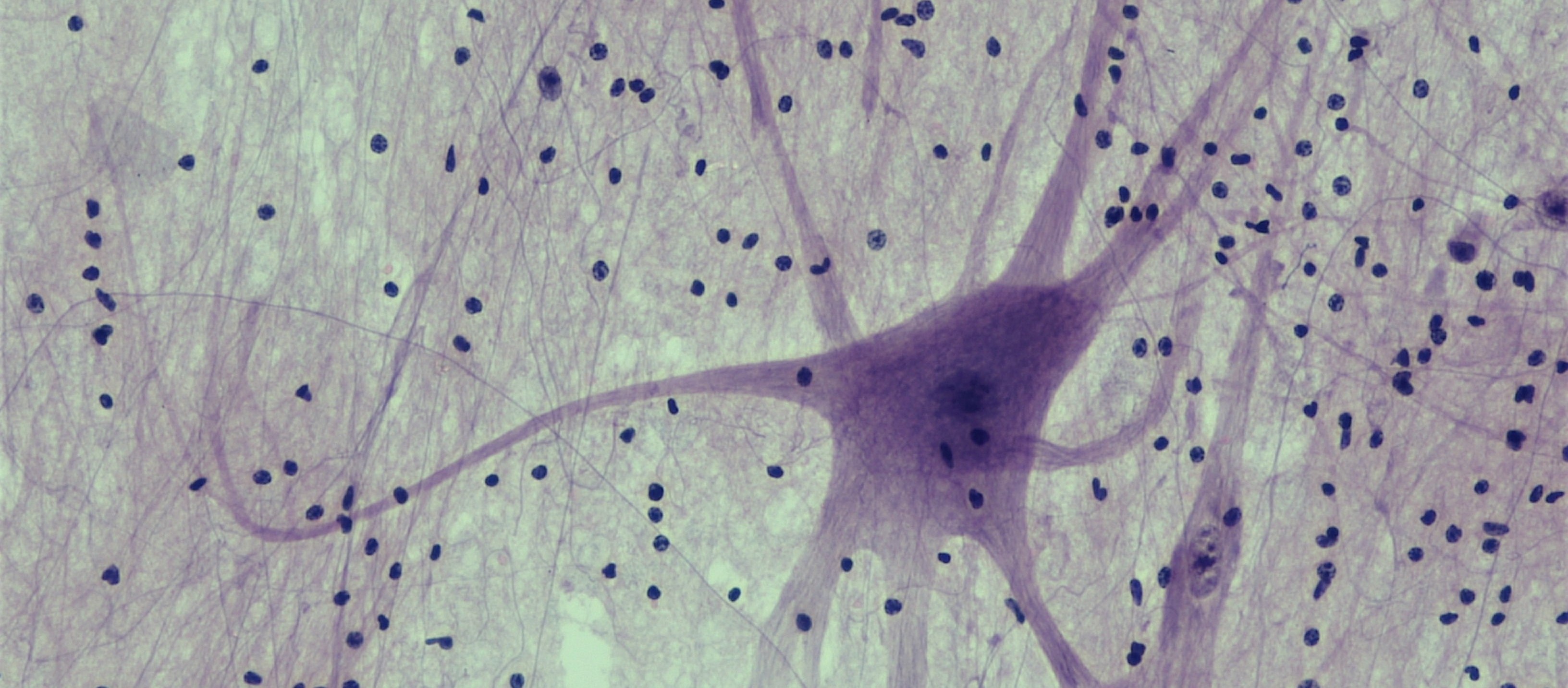 neurons